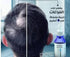 Strongville Hair Loss Lotion for Men 100 ml - Strongville
